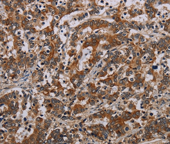 Anti-NLRP9 Antibody