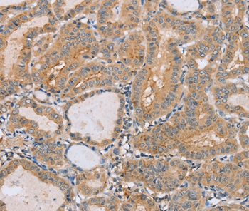 Anti-PTPN4 Antibody