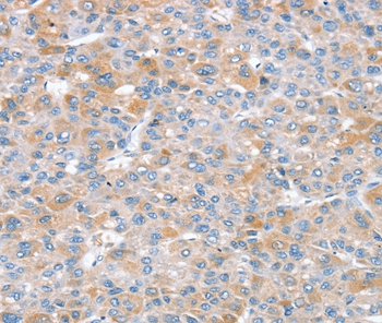 Anti-SNX25 Antibody