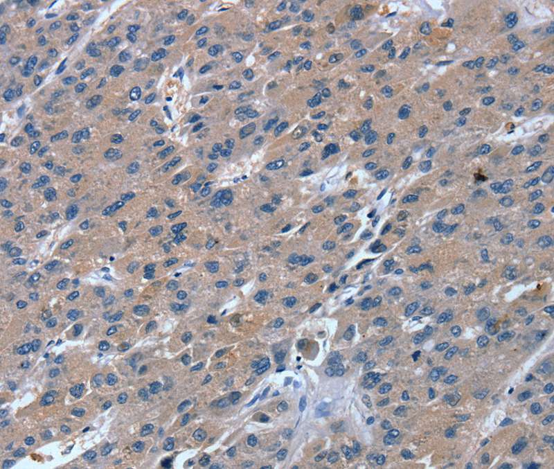 Anti-RGS11 Antibody