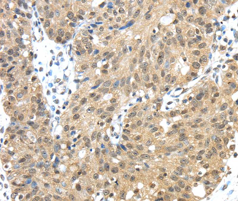 Anti-TMED3 Antibody