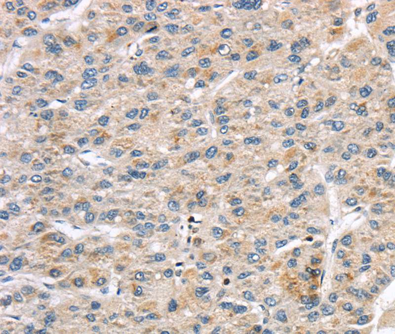 Anti-LZTS1 Antibody