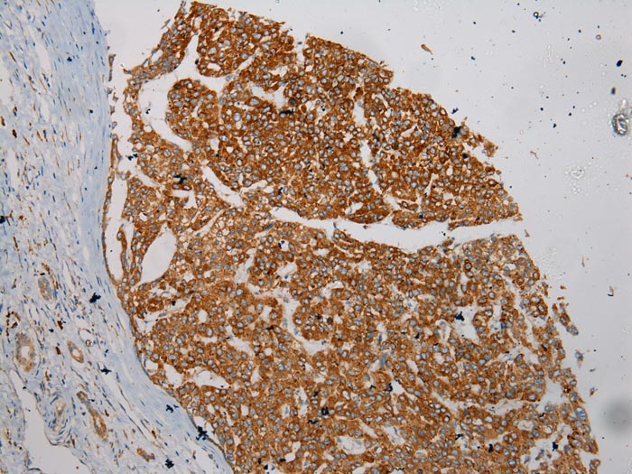 Anti-WFDC1 Antibody Anti-WFDC1 Antibody