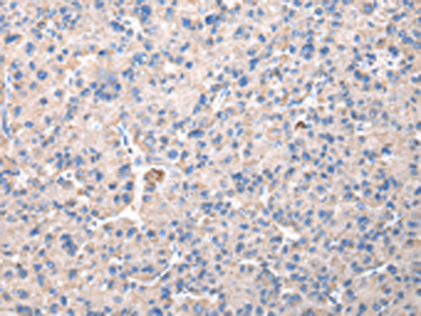 Anti-CHMP3 Antibody