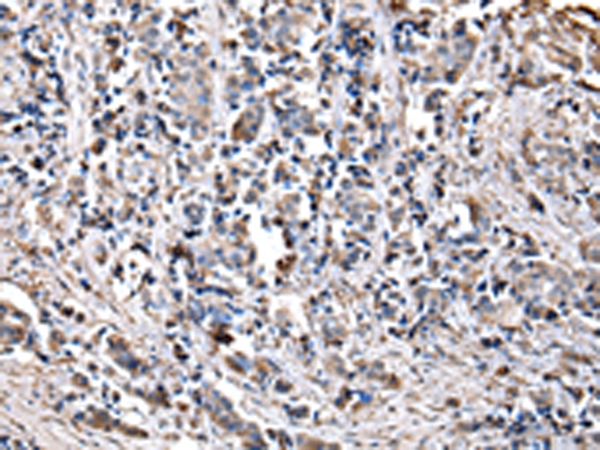 Anti-CHMP3 Antibody Anti-CHMP3 Antibody