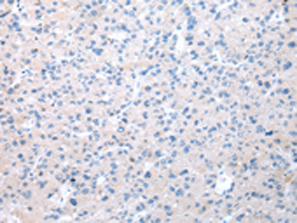 Anti-WDR19 Antibody