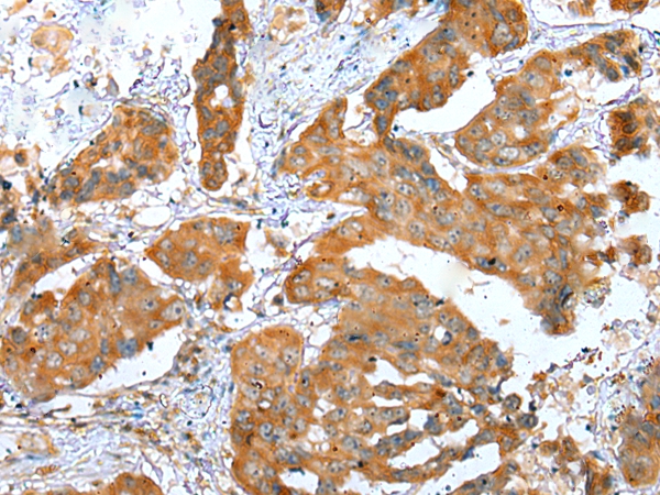 Anti-ERMP1 Antibody