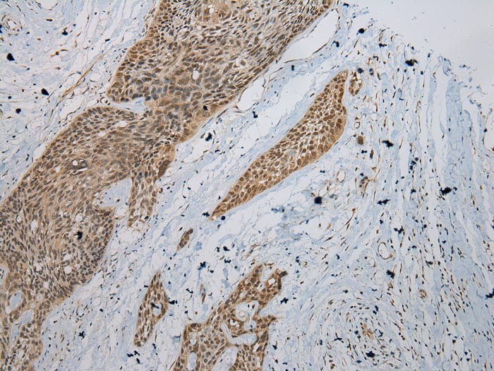 Anti-ZBTB2 Antibody Anti-ZBTB2 Antibody