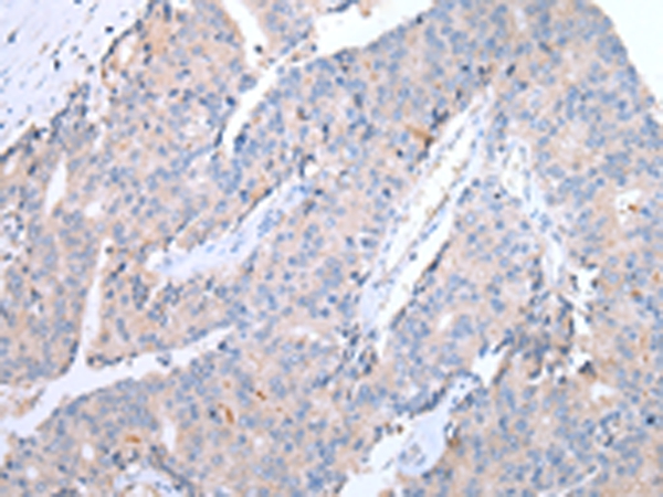 Anti-CCR10 Antibody