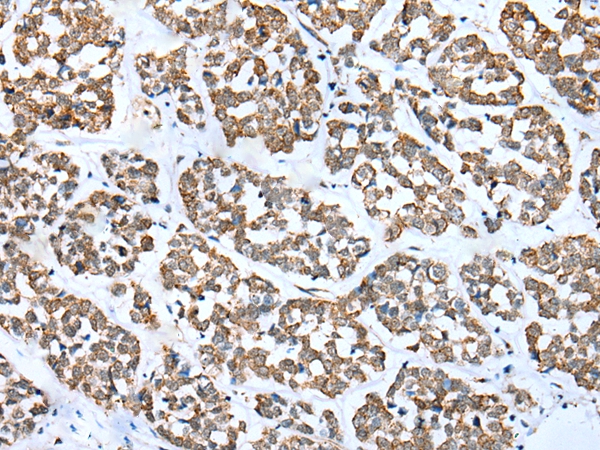 Anti-FSD1L Antibody