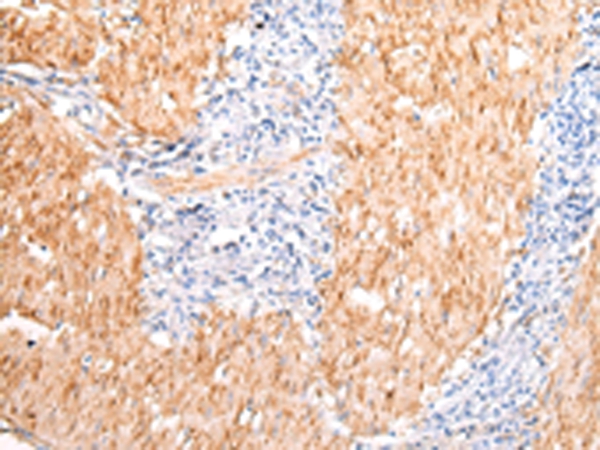 Anti-DMBT1 Antibody