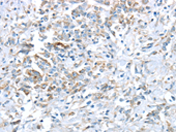 Anti-VWCE Antibody Anti-VWCE Antibody