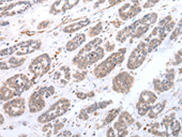 Anti-CPT1C Antibody Anti-CPT1C Antibody