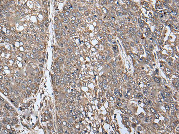 Anti-ATAD1 Antibody