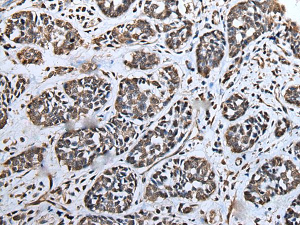 Anti-ATAD1 Antibody Anti-ATAD1 Antibody