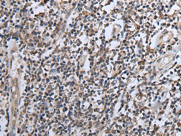 Anti-CXCL6 Antibody