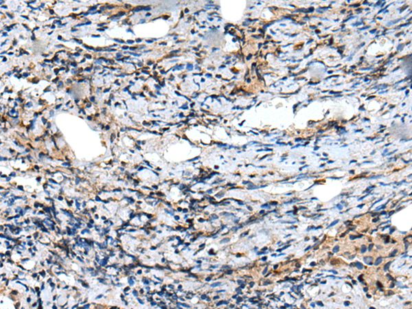 Anti-CXCL6 Antibody Anti-CXCL6 Antibody