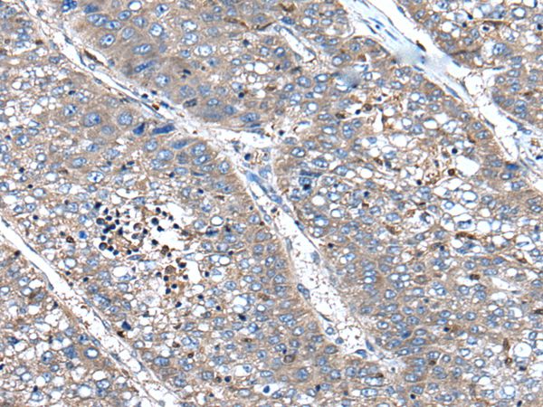 Anti-XIRP1 Antibody