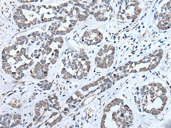 Anti-ENKUR Antibody Anti-ENKUR Antibody