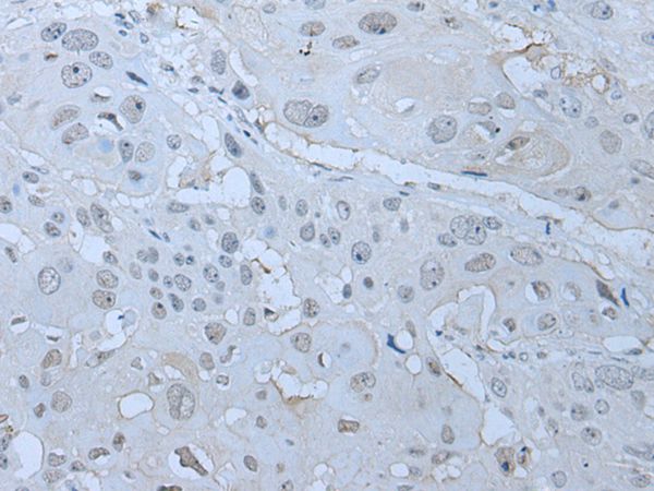 Anti-HUWE1 Antibody