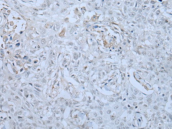 Anti-HUWE1 Antibody Anti-HUWE1 Antibody