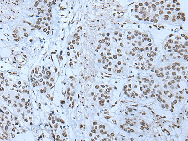 Anti-ZBTB4 Antibody