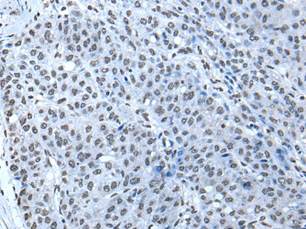 Anti-ZBTB4 Antibody Anti-ZBTB4 Antibody