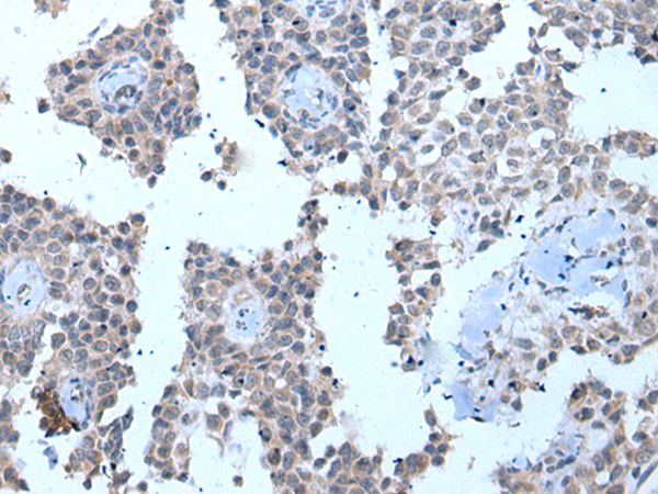 Anti-ZMYM2 Antibody