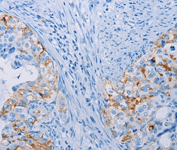 Anti-CA10 Antibody