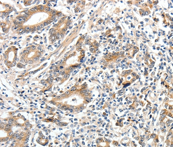 Anti-ECE2 Antibody Anti-ECE2 Antibody