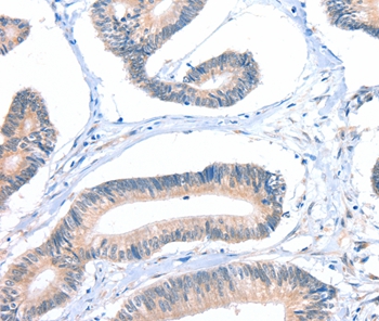Anti-FHL5 Antibody