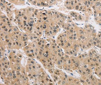 Anti-AMZ2 Antibody Anti-AMZ2 Antibody