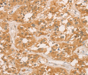 Anti-CPB1 Antibody
