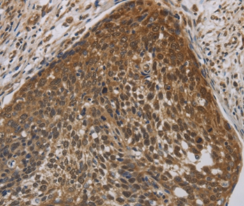 Anti-CYBA Antibody Anti-CYBA Antibody