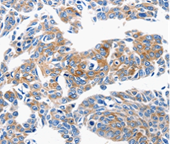 Anti-CCL6 Antibody