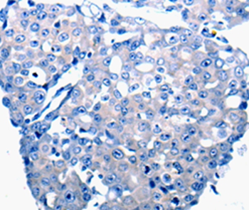 Anti-CCL2 Antibody