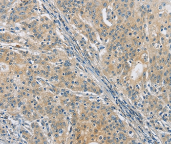 Anti-PKD1 Antibody