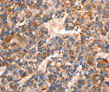 Anti-GJA8 Antibody