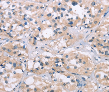 Anti-ELP3 Antibody Anti-ELP3 Antibody