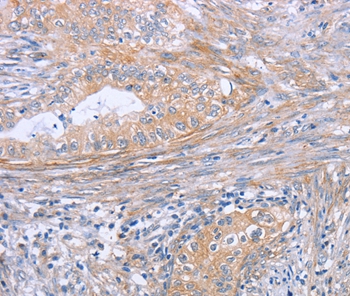 Anti-BOD1 Antibody