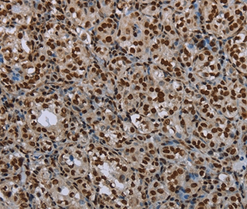 Anti-LEO1 Antibody Anti-LEO1 Antibody