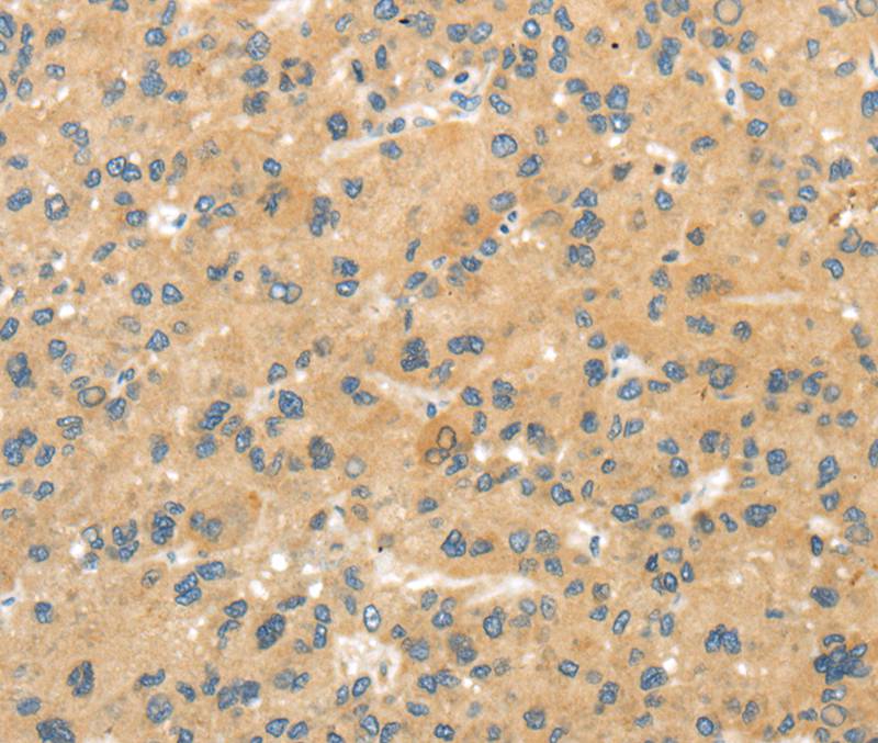 Anti-MPP6 Antibody
