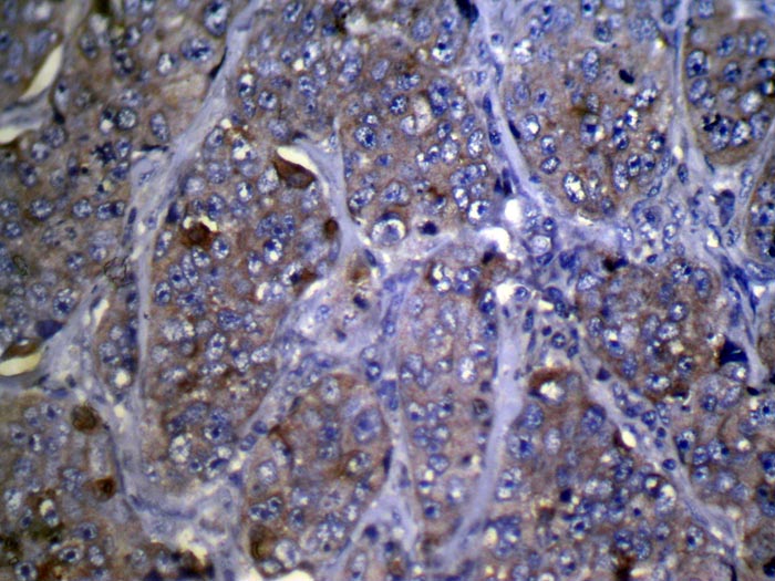 Anti-ZFP2 Antibody