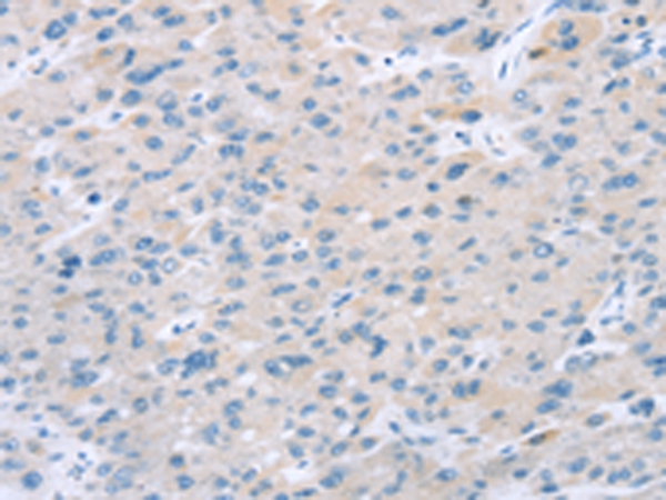 Anti-EI24 Antibody