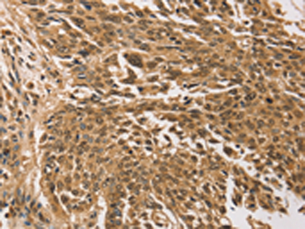 Anti-TGM7 Antibody