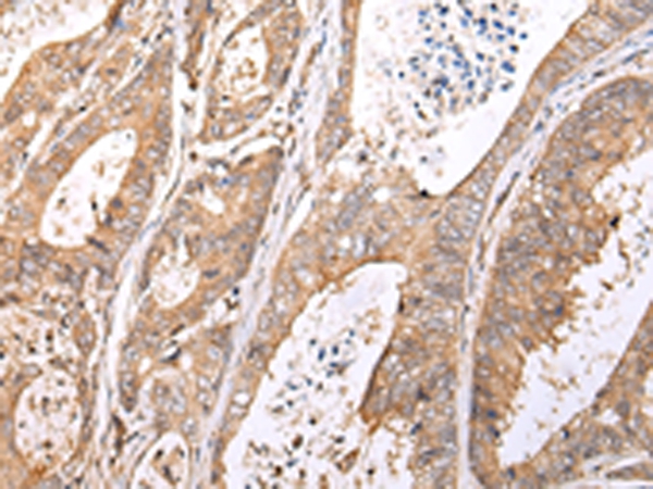 Anti-XKR7 Antibody