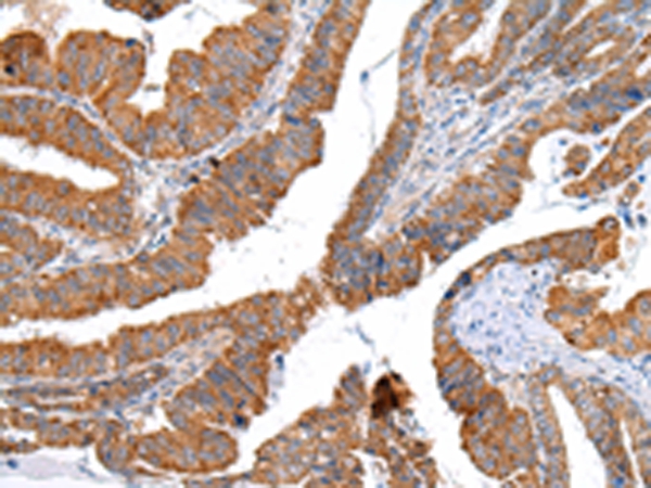 Anti-XKR4 Antibody