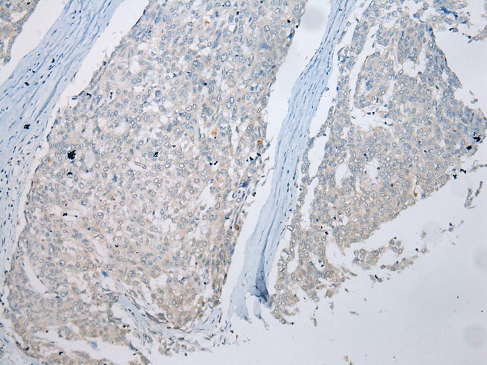 Anti-MUC7 Antibody Anti-MUC7 Antibody