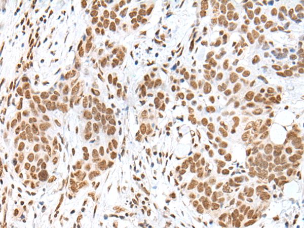 Anti-HCN3 Antibody
