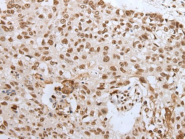 Anti-HCN3 Antibody Anti-HCN3 Antibody